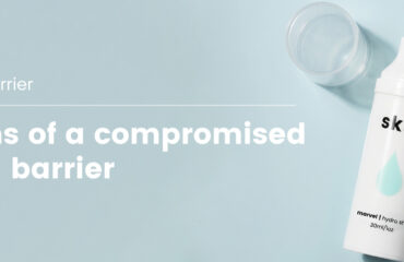 SK-Blog-Signs-of-a-Compromised-Skin-Barrier SK-Blog-Signs-of-a-Compromised-Skin-Barrier